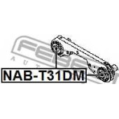 Опора, дифференциал FEBEST NAB-T31DM